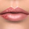 Pimple on Lip
